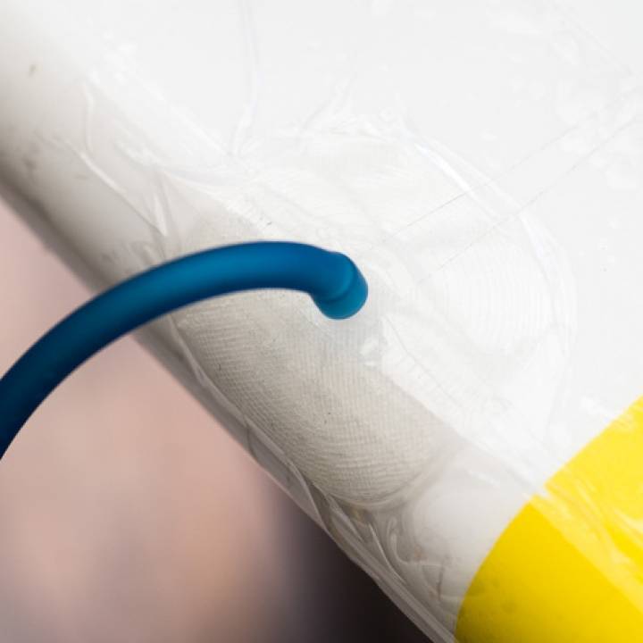 3D Printable Vacuum Patch by Walter Hsiao