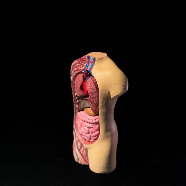 3D-Printed Anatomical Model