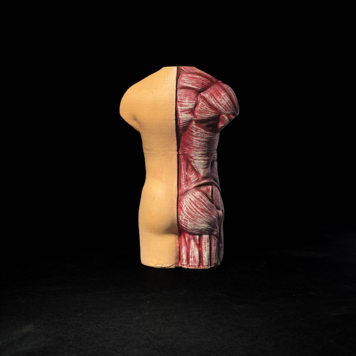 3D-Printed Anatomical Model image