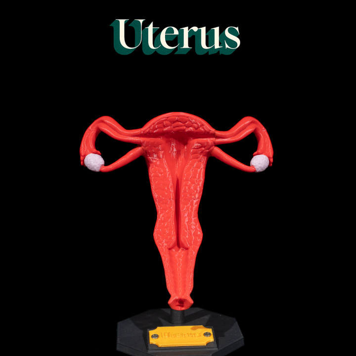 Uterus image